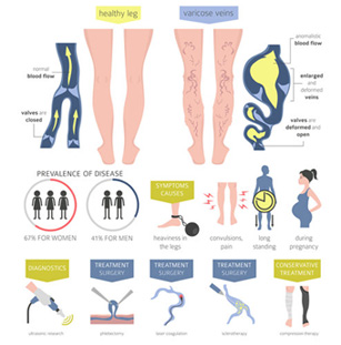 Vascular Disease Infographic